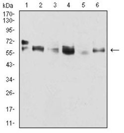 Cytokeratin 5 Antibody (2C8E4) - BSA Free, Novus Biologicals:Antibodies:Primary