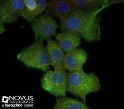 Cytokeratin 5 Antibody - BSA Free, Novus Biologicals 0.1mg:Antibodies,