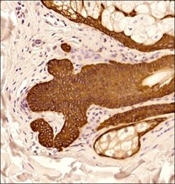 Cytokeratin 5 Antibody - BSA Free, Novus Biologicals 0.1mg:Antibodies,
