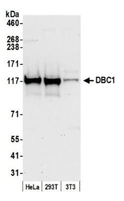 DBC1/p30 Antibody, Novus Biologicals 0.1mL; Unlabeled:Antibodies, Polyclonal