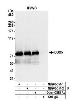 DDX5 Antibody, Novus Biologicals 0.1mL; Unlabeled:Antibodies, Polyclonal