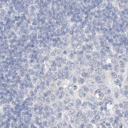 DNAH5 Antibody, Novus Biologicals:Antibodies:Primary Antibodies
