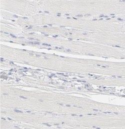 ELF3/ESE-1 Antibody, Novus Biologicals 0.1mL; Unlabeled:Antibodies, Polyclonal