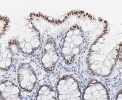 ELF3/ESE-1 Antibody, Novus Biologicals 0.1mL; Unlabeled:Antibodies, Polyclonal