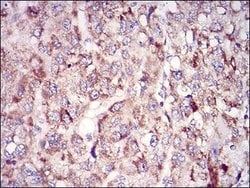 Epsilon 1 Tubulin Antibody (5F3B7) - BSA Free, Novus Biologicals 0.1mg;