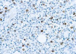 Epstein Barr Virus Antibody (CS1, CS2, CS3, CS4), Novus Biologicals 0.1