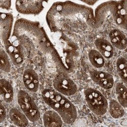 FAM119A Antibody, Novus Biologicals 0.1mL; Unlabeled:Antibodies, Polyclonal