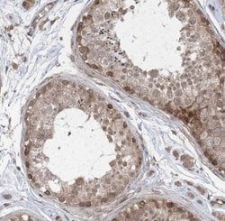 FAM119A Antibody, Novus Biologicals 0.1mL; Unlabeled:Antibodies, Polyclonal