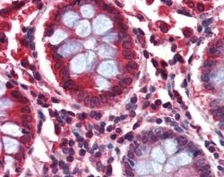 GAD2/GAD65 Antibody, Novus Biologicals 0.1mg; Unlabeled:Antibodies, Polyclonal