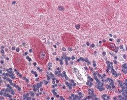 GAD2/GAD65 Antibody, Novus Biologicals 0.1mg; Unlabeled:Antibodies, Polyclonal