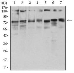 GFPT1 Antibody (1F1A4) - BSA Free, Novus Biologicals 0.1mg; Unlabeled:Antibodies,