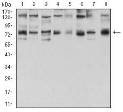 GFPT1 Antibody (1F1B9) - BSA Free, Novus Biologicals 0.1mg; Unlabeled:Antibodies,