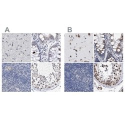 GM130/GOLGA2 Antibody, Novus Biologicals 0.1mL; Unlabeled:Antibodies, Polyclonal