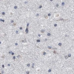 GM130/GOLGA2 Antibody, Novus Biologicals 0.1mL; Unlabeled:Antibodies, Polyclonal