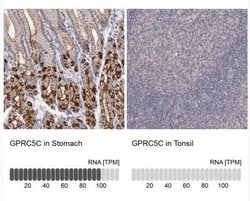 GPRC5C Antibody, Novus Biologicals 25 &mu;L; Unlabeled:Antibodies, Polyclonal