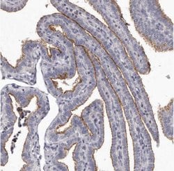 GPRC5C Antibody, Novus Biologicals 25 &mu;L; Unlabeled:Antibodies, Polyclonal