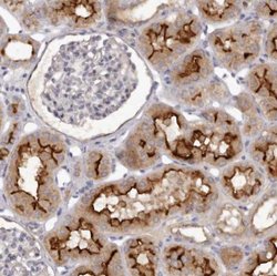 GPRC5C Antibody, Novus Biologicals 25 &mu;L; Unlabeled:Antibodies, Polyclonal