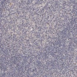 GPRC5C Antibody, Novus Biologicals 25 &mu;L; Unlabeled:Antibodies, Polyclonal