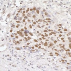 GTF3C5 Antibody, Novus Biologicals 0.1mL; Unlabeled:Antibodies, Polyclonal