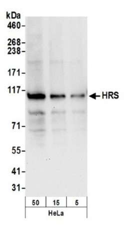 HGS Antibody, Novus Biologicals 0.1mL; Unlabeled:Antibodies, Polyclonal