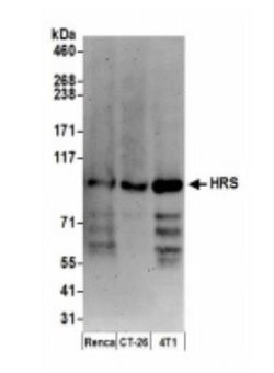 HGS Antibody, Novus Biologicals 0.1mL; Unlabeled:Antibodies, Polyclonal