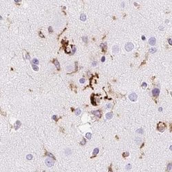 HLA DRA Antibody, Novus Biologicals 0.1 mL | Buy Online | Novus Biologicals | Fisher Scientific