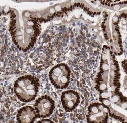 HNF-4 alpha/NR2A1 Antibody, Novus Biologicals 25 &mu;L; Unlabeled:Antibodies,