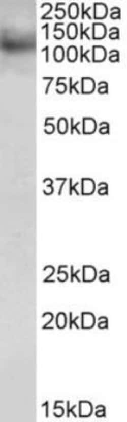 HOIP/RNF31 Antibody, Novus Biologicals 0.1mg; Unlabeled:Antibodies, Polyclonal