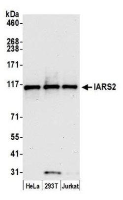 IARS2 Rabbit anti-Human, Polyclonal, Novus Biologicals 100&mu;L; Unlabeled:Antibodies,