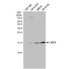 IGF-I/IGF-1 Antibody, Novus Biologicals 0.1 mL | Buy Online | Novus Biologicals | Fisher Scientific