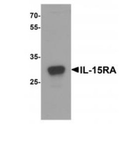 IL-15R alpha Antibody - BSA Free, Novus Biologicals 0.025 mg, Unlabeled:Antibodies,