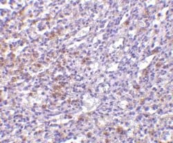 IL-27R alpha/WSX-1/TCCR Antibody, Novus Biologicals 0.025mg:Antibodies,