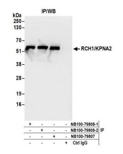 Importin alpha 2/KPNA2 Antibody, Novus Biologicals 0.1mL; Unlabeled:Antibodies,