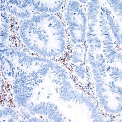 Indoleamine 2,3-dioxygenase/IDO Antibody (BLR031F), Novus Biologicals 100