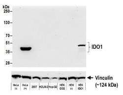 Indoleamine 2,3-dioxygenase/IDO Antibody (BLR031F), Novus Biologicals 100