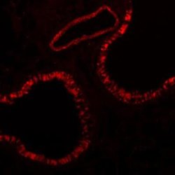 Integrin beta 3/CD61 Antibody (SJ19-09), Novus Biologicals 100&mu;L:Antibodies,