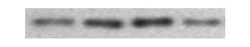 Integrin beta 3/CD61 Antibody (SJ19-09), Novus Biologicals 100&mu;L:Antibodies,