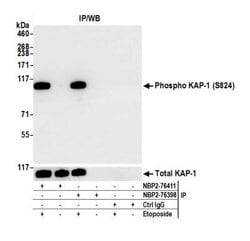 KAP1, p Ser824 Antibody (BL-246-7B5), Novus Biologicals 100 &mu;L | Buy Online | Novus Biologicals | Fisher Scientific