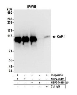 KAP1 Antibody (BL-248-2G6), Novus Biologicals 100 &mu;L; Unconjugated:Antibodies,