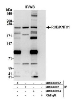 KNTC1 Antibody, Novus Biologicals 0.1mL; Unlabeled:Antibodies, Polyclonal