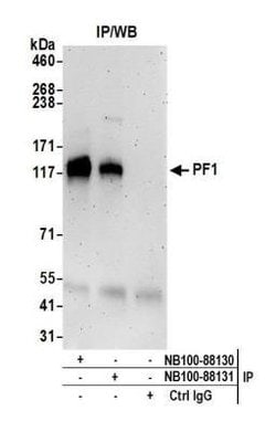 KNTC1 Antibody, Novus Biologicals 0.1mL; Unlabeled:Antibodies, Polyclonal
