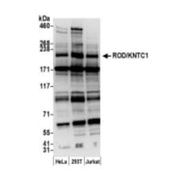 KNTC1 Antibody, Novus Biologicals 0.1mL; Unlabeled:Antibodies, Polyclonal