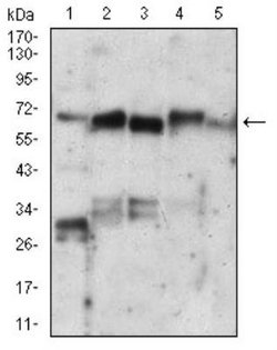 Ku70/XRCC6 Antibody (7A9E7) - BSA Free, Novus Biologicals 0.1mg; Unlabeled:Antibodies,