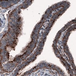 LAMP-1/CD107a Antibody (CL3482), Novus Biologicals 25 &mu;L:Antibodies,