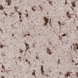 LAMP-1/CD107a Antibody (CL3482), Novus Biologicals 25 &mu;L:Antibodies,