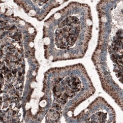 LAMP-1/CD107a Antibody (CL3482), Novus Biologicals 25 &mu;L:Antibodies,
