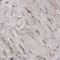 LAMP-1/CD107a Antibody (CL3482), Novus Biologicals 25 &mu;L:Antibodies,