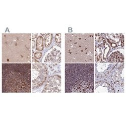 LAP1B Antibody, Novus Biologicals 25 &mu;L; Unlabeled:Antibodies, Polyclonal