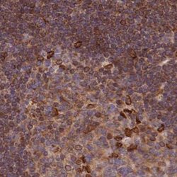 LAP1B Antibody, Novus Biologicals 25 &mu;L; Unlabeled:Antibodies, Polyclonal