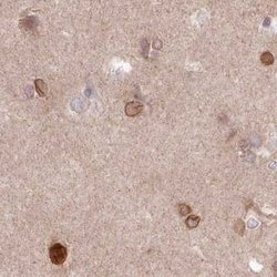 LAP1B Antibody, Novus Biologicals 25 &mu;L; Unlabeled:Antibodies, Polyclonal